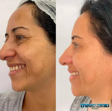 single